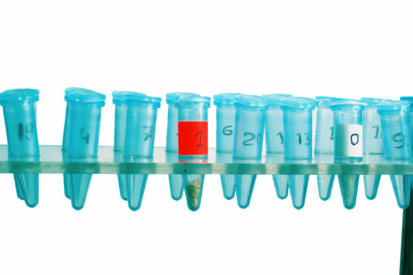 Making Decisions Simple